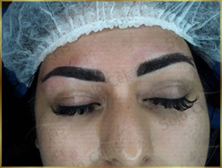 Microblading